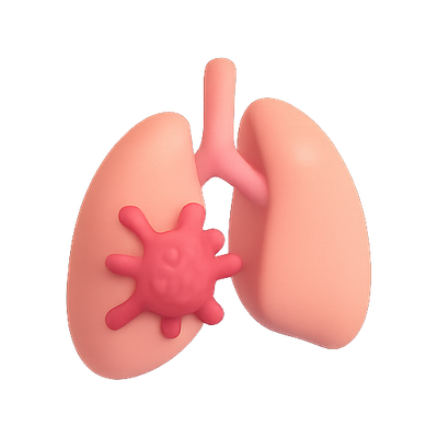 3D Illustration of Lungs with Virus Representation