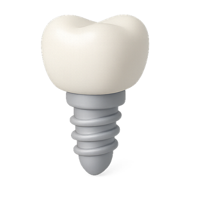 3D Dental Implant Model for Educational Use